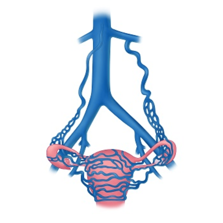 Pelvic Venous Disorder